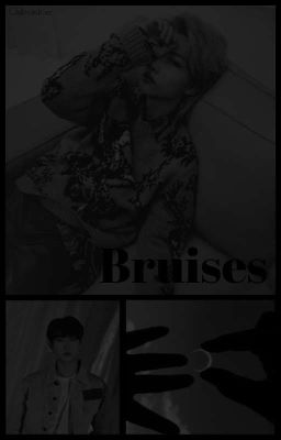 Bruises ✘ [Changlix]