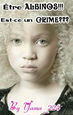 Être albinos !! Est ce un crime ? ? ?