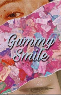 Gummy Smile