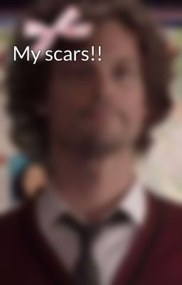 My scars!!