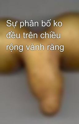 Sự phân bố ko đều trên chiều rộng vành răng