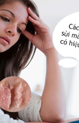 Sự thật về cách chữa sùi mào gà tại nhà có thực sự hiệu quả